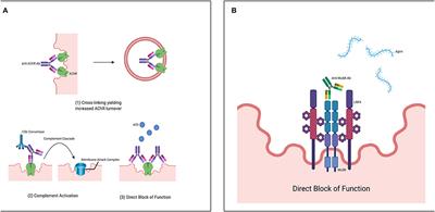 Immunopathology of Autoimmune Myasthenia Gravis: Implications for Improved Testing Algorithms and Treatment Strategies